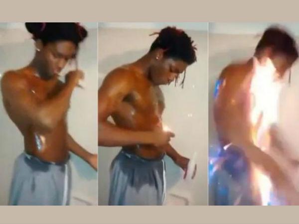 After Ice Bucket Challenge, Facebook 'fire challenge' faces criticism After Ice Bucket Challenge, Facebook 'fire challenge' faces criticism