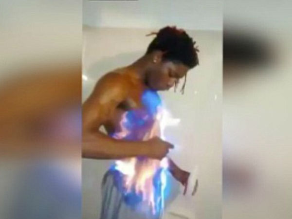 After Ice Bucket Challenge, Facebook 'fire challenge' faces criticism After Ice Bucket Challenge, Facebook 'fire challenge' faces criticism