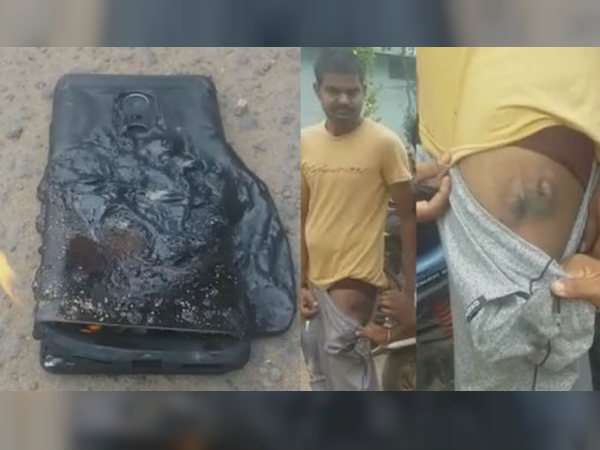 Xiaomi Redmi Note 4 reportedly catches fire in the owner's pocket