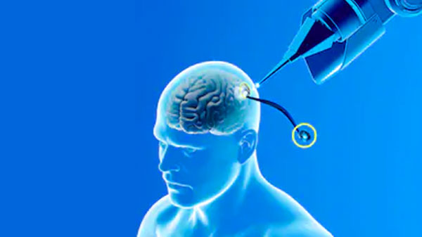 Tiny Probe Inside Your Head