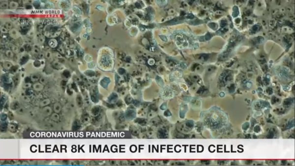 8K Image Of Coronavirus Infected Cells Reveals New Details