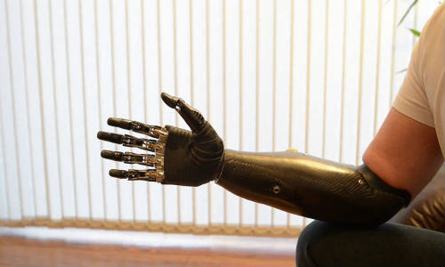 terminator-arm-bebionic3-rslsteeper-1