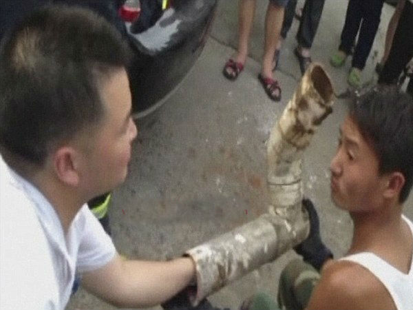  ಟಾಯ್ಲೆಟ್ ಪೈಪ್‌ನಲ್ಲಿ ಸಿಕ್ಕಿಬಿದ್ದ ಮಗುವನ್ನು ರಕ್ಷಣೆ ಮಾಡಿದ್ದು ಹೇಗೆ ?