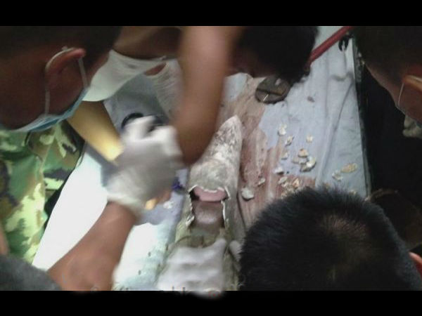  ಟಾಯ್ಲೆಟ್ ಪೈಪ್‌ನಲ್ಲಿ ಸಿಕ್ಕಿಬಿದ್ದ ಮಗುವನ್ನು ರಕ್ಷಣೆ ಮಾಡಿದ್ದು ಹೇಗೆ ?