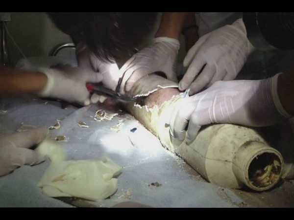  ಟಾಯ್ಲೆಟ್ ಪೈಪ್‌ನಲ್ಲಿ ಸಿಕ್ಕಿಬಿದ್ದ ಮಗುವನ್ನು ರಕ್ಷಣೆ ಮಾಡಿದ್ದು ಹೇಗೆ ?