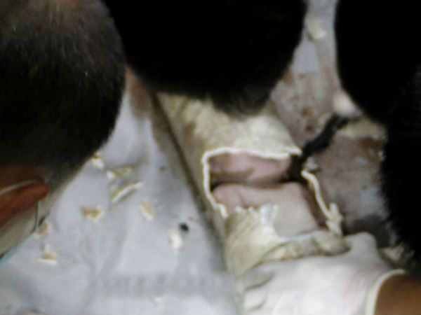  ಟಾಯ್ಲೆಟ್ ಪೈಪ್‌ನಲ್ಲಿ ಸಿಕ್ಕಿಬಿದ್ದ ಮಗುವನ್ನು ರಕ್ಷಣೆ ಮಾಡಿದ್ದು ಹೇಗೆ ?