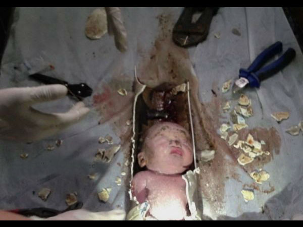  ಟಾಯ್ಲೆಟ್ ಪೈಪ್‌ನಲ್ಲಿ ಸಿಕ್ಕಿಬಿದ್ದ ಮಗುವನ್ನು ರಕ್ಷಣೆ ಮಾಡಿದ್ದು ಹೇಗೆ ?