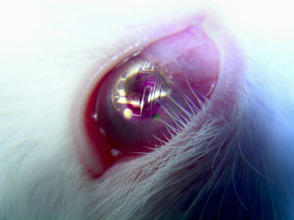 ಕಾಂಟಾಕ್ಟ್‌ ಲೆನ್ಸ್‌ ಅವತಾರ್‌