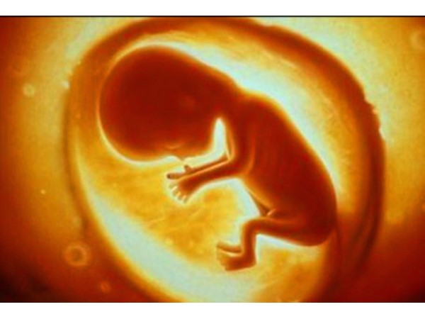 ಜನಿಸುವ ಮಗುವಿಗೆ ಅಪಘಾತ