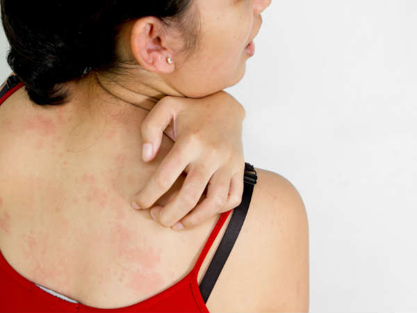 ಚರ್ಮ ತೊಂದರೆಗಳು