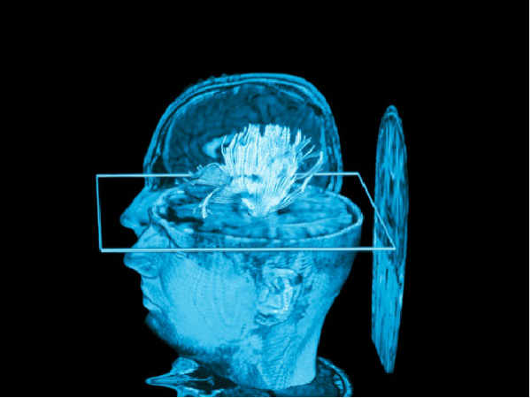 ಮೈಂಡ್‌ ರೀಡಿಂಗ್‌ ಮತ್ತು ಮೆಮೊರಿ ರೆಕಾರ್ಡಿಂಗ್‌ ಸ್ಕ್ಯಾನ್‌