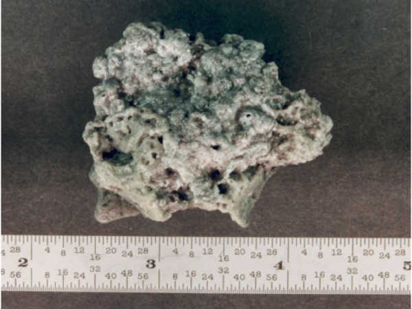 ಅಪಾಯಕಾರಿ ಕಣ