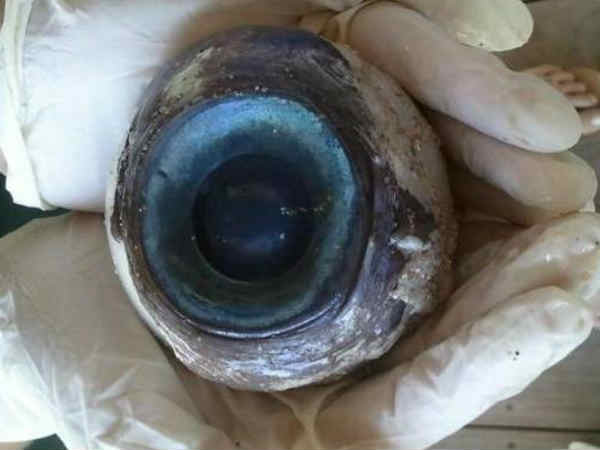 ಕಣ್ಣು ಕಣ್ಣು