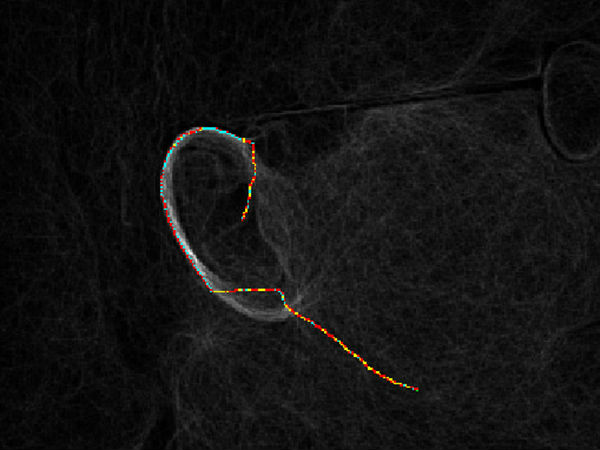 ಇನ್ನು ಇದೆ: 