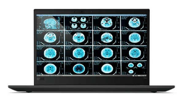 ಪ್ರೊಸೆಸರ್ ಯಾವುದು? 