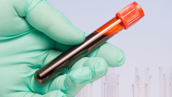 ರಕ್ತನಾಳ