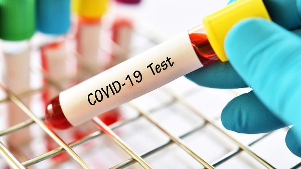 ಲ್ಯಾಬ್‌ನ ವೆಬ್‌ಸೈಟ್‌ನಲ್ಲಿ COVID-19 ಟೆಸ್ಟ್‌ ರಿಸಲ್ಟ್‌ ಅನ್ನು ತಿಳಿಯುವುದು ಹೇಗೆ?