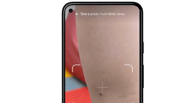 ಗೂಗಲ್ ಡರ್ಮಟಾಲಜಿ ಅಸಿಸ್ಟ್ ಟೂಲ್ ಹೇಗೆ ಕಾರ್ಯನಿರ್ವಹಿಸುತ್ತದೆ? ಗೂಗಲ್ ಡರ್ಮಟಾಲಜಿ ಅಸಿಸ್ಟ್ ಟೂಲ್ ಹೇಗೆ ಕಾರ್ಯನಿರ್ವಹಿಸುತ್ತದೆ?