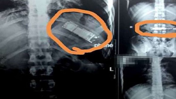 ಮೊಬೈಲ್‌ 