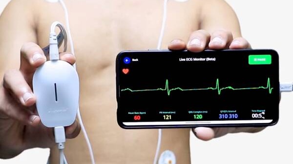 ECG ECG