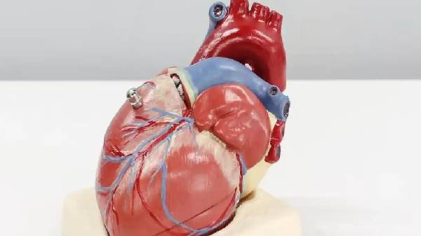 ಪ್ರತಿವರ್ಷ 17.9 ಮಿಲಿಯನ್ ಜನ ಸಾಯುತ್ತಿದ್ದಾರೆ