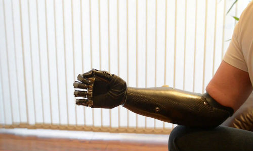 Terminator-arm-bebionic3-rslsteeper-2