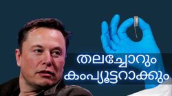 Elon Musk | മനുഷ്യന്റെ തലച്ചോറും കംപ്യൂട്ടറാകും; ഇനി 6 മാസം കൂടി മതിയെന്ന് ഇലോൺ മസ്ക്