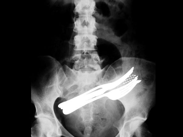 Worst x rays