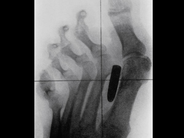 Worst xrays