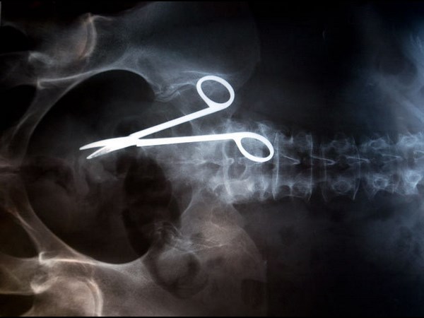 Worst Xrays