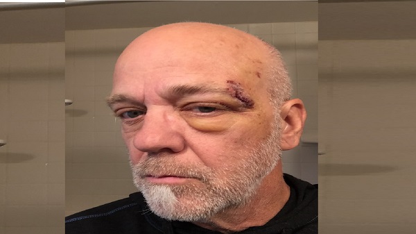 എമർജൻസി സർവ്വിസിലേക്കും സന്ദേശം