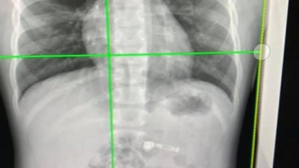 ആപ്പിൾ എയർപോഡ്