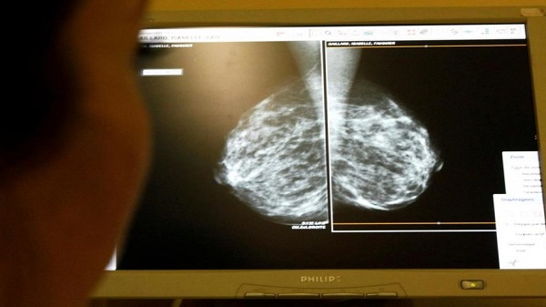 റേഡിയോളജിസ്റ്റുകൾ 