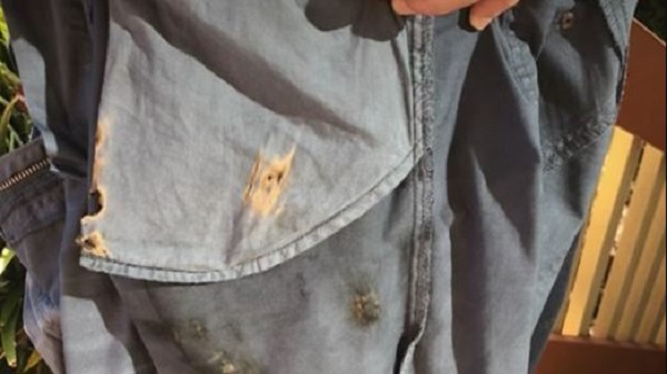 പോക്കറ്റിൽ നിന്നും പൊട്ടിത്തെറിച്ചു