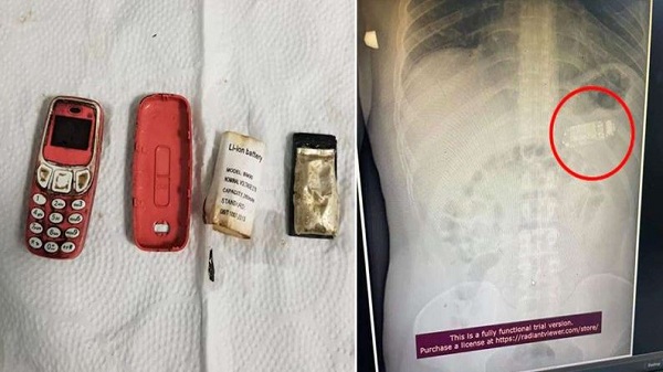 ബാറ്ററി