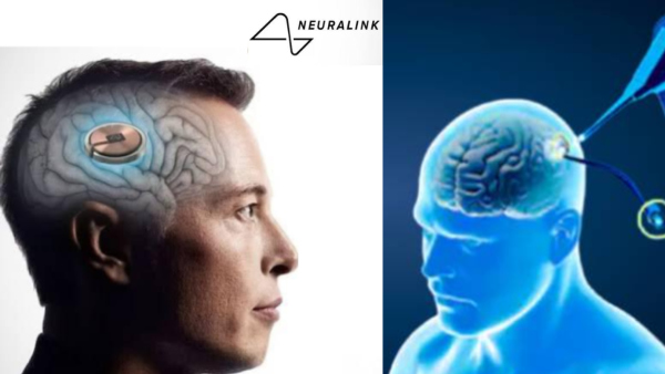 യന്ത്രമനുഷ്യൻ നിജമാകുന്നു! ആദ്യമായി മനുഷ്യ തലച്ചോറിൽ ചിപ് ഘടിപ്പിച്ചു