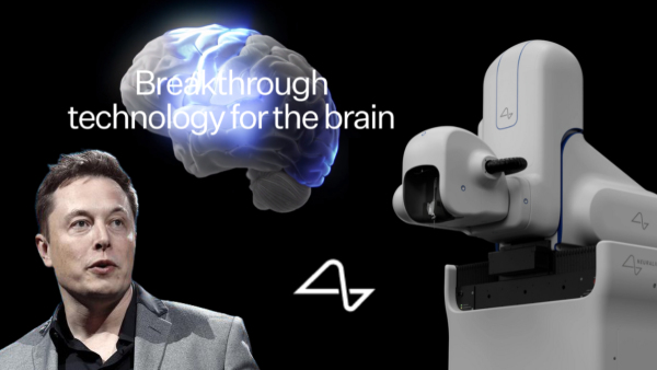 ഒറ്റദിവസം 2 ശസ്ത്രക്രിയകൾ വിജയകരമാക്കി ന്യൂറലിങ്ക്