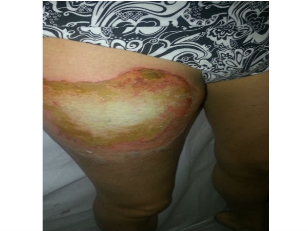 காலக்ஸி எஸ் 3 மொபைல் வெடித்தது