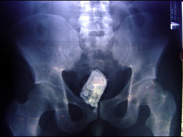 மருத்துவ உலகம் கண்டு வியந்த எக்ஸ் ரே படங்கள் 