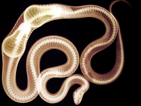 மருத்துவ உலகம் கண்டு வியந்த எக்ஸ் ரே படங்கள் 