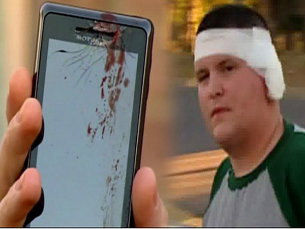 வெடிக்கும் மொபைல்கள் குழப்பத்தில் கம்பெனிகள்!!!