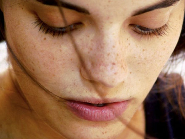 முகப்பரு