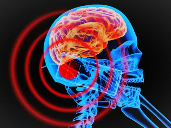  கதிர்வீச்சு