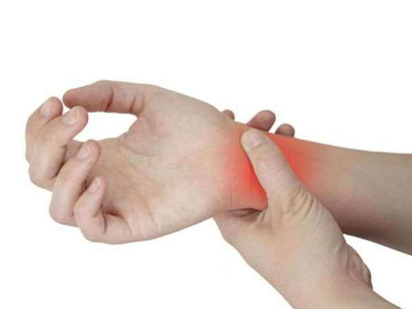 Carpal Tunnel Syndrome