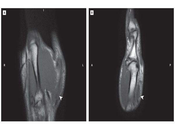 கேண்டி க்ரஷ் சாகா..?! மவனே செத்தடா..!