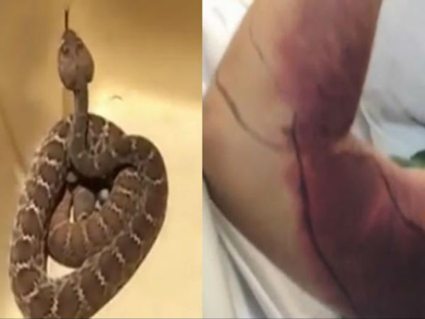 செல்பீ எடுத்தால் என்ன ஆகும்..? 153,161 டாலர் செலவாகும்..!