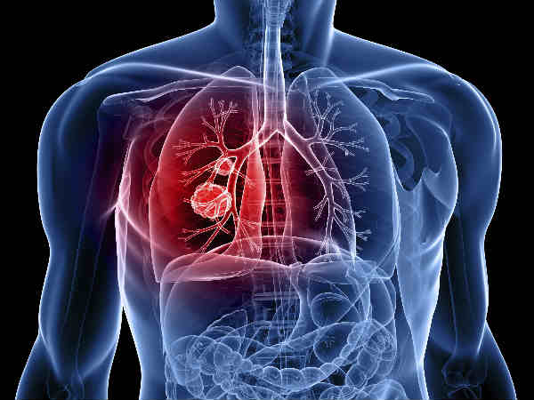 02. புற்றுநோய் :