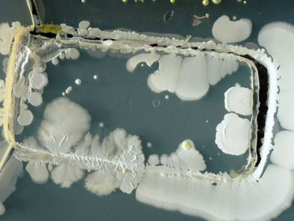 09. தொற்று :