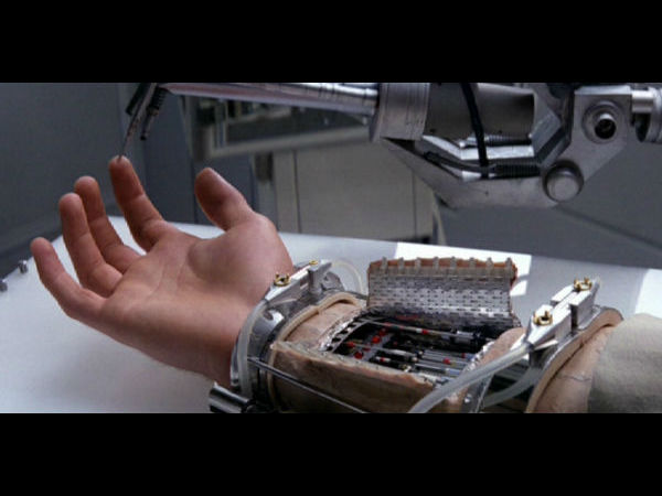 11. ப்ரோஸ்தெடிக்ஸ் :