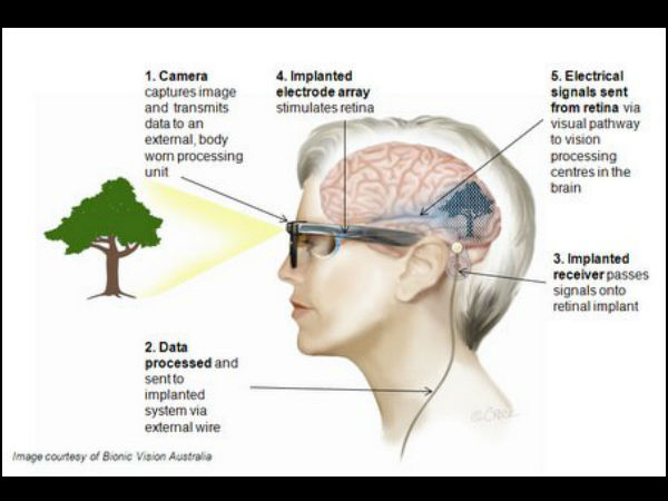 பார்வை குறைபாடுகளை சரி செய்யும் செயற்கை கண் கண்டுபிடிப்பு..!! 
